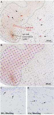 A Preliminary Report: The Hippocampus and Surrounding Temporal Cortex of Patients With Schizophrenia Have Impaired Blood-Brain Barrier